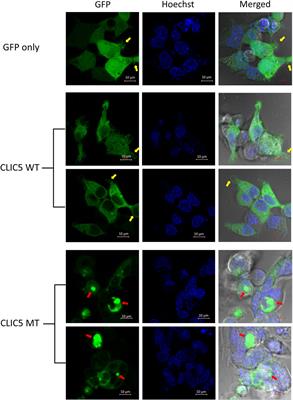 Cell-based analysis of CLIC5A and SLC12A2 variants associated with hearing impairment in two African families